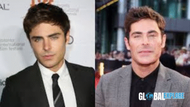 zac efron surgery